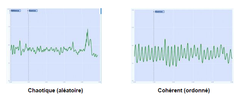 coherence-cardique-1.png